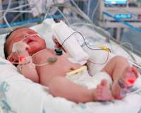 Причины пневмонии у новорожденного в первые часы жизни thumbnail