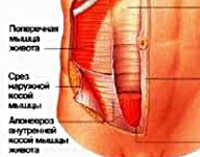 Грыжа спигелиевой линии живота анатомия thumbnail