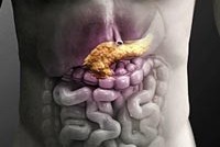 Лечение хронического панкреатита и заболеваний поджелудочной железы thumbnail