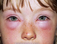 Аллергия у животных на цветущие thumbnail