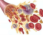 Для апластической анемии характерны клинические признаки thumbnail
