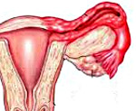 Аднексит или сальпингоофорит воспаление придатков матки яичников и маточных труб thumbnail
