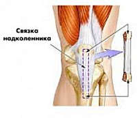 Пластика на коленного сустава thumbnail