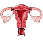 Гипоплазия матки это может быть киста яичника thumbnail