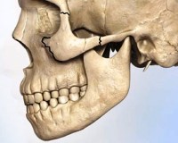 Перелом скуловой кости классификация клиника лечение thumbnail