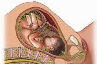 Внутриутробная инфекция у ребенка 2 года thumbnail